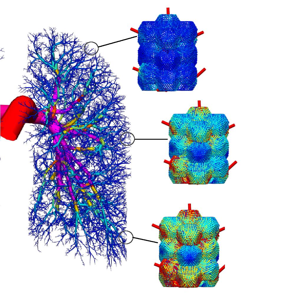 pulmonary arterial model